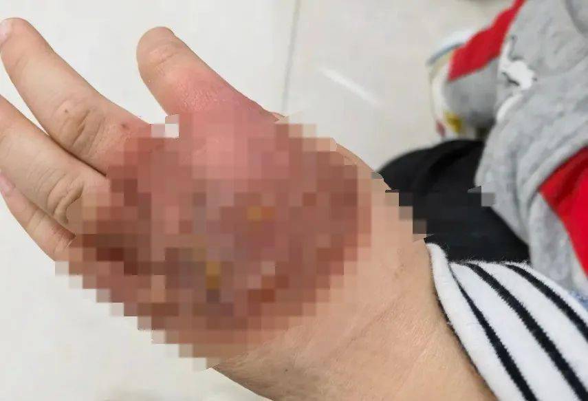 四度抗癌成功被射杀