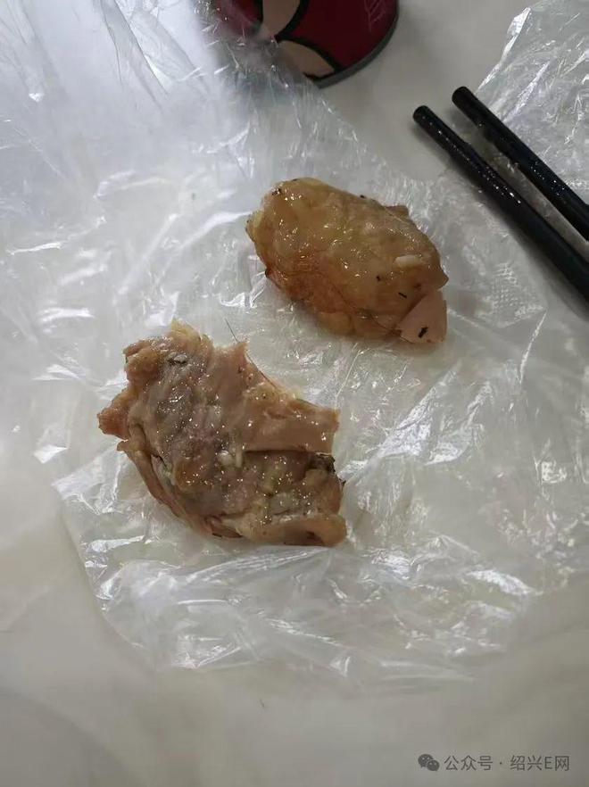 震惊！小伙连吃28天鸡腿饭瘦了10多斤，医生揭秘背后真相！